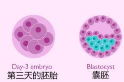 三代试管是不是都要养囊？解析胚胎培育的新趋势