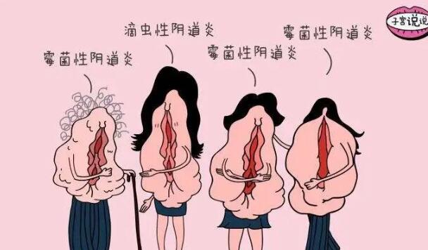 旧社会女性鱼口病是什么病毒