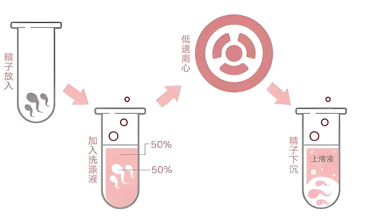 什么是洗精术,洗精术原理、流程、成功率、收费介绍