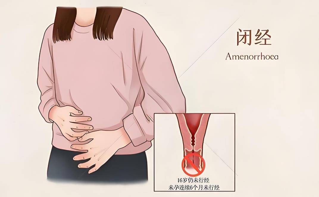 闭经会不会怀孕,闭经怀孕的概率